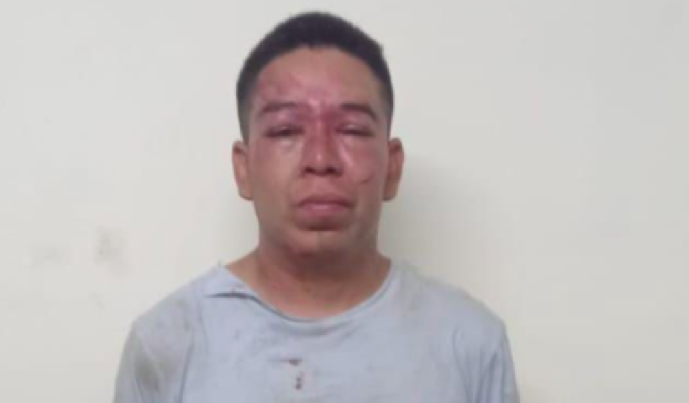 Conductor con 219 grados de alcohol choca contra negocios en Tepecoyo