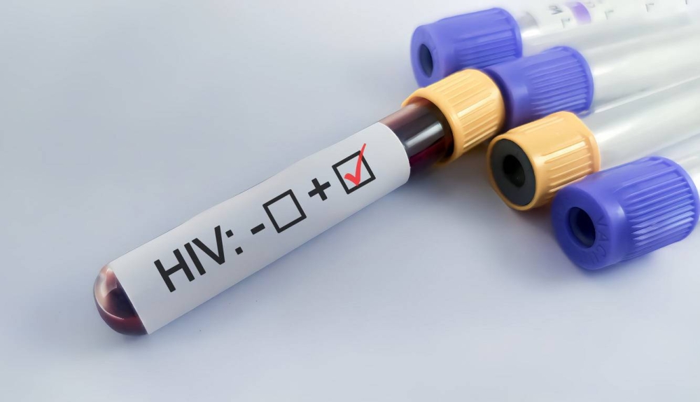 Descartan aumento de casos de VIH en El Salvador