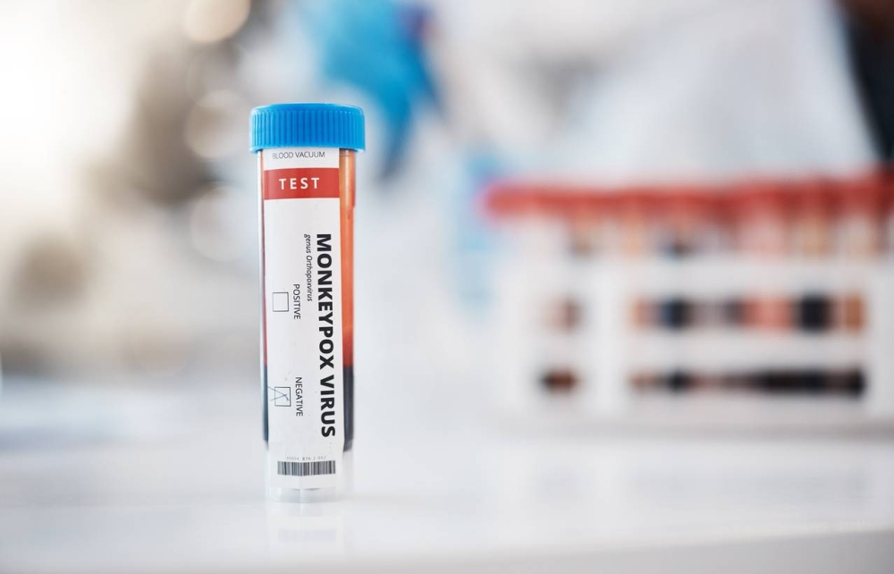 África logra reducir los casos confirmados de mpox, pero persiste la falta de vacunas