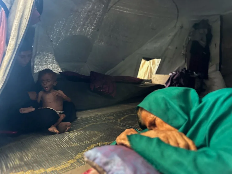 Enfermos y desnutridos, los niños de Gaza que Israel llama fake news también pasan hambre