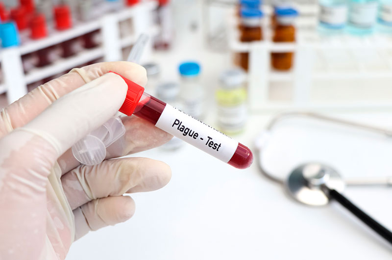 EE.UU. detecta caso de peste bubónica en un residente de California