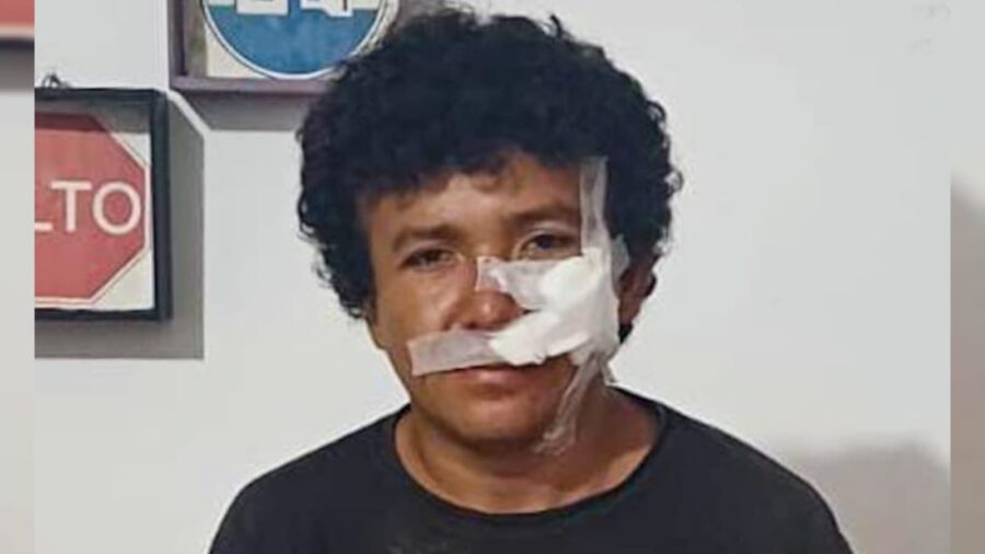 Detienen a motociclista con 235 grados de alcohol tras chocar contra un bus en Santiago de María