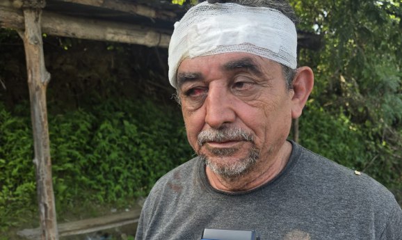 Arrestan a conductor ebrio tras provocar un accidente en Chalatenango