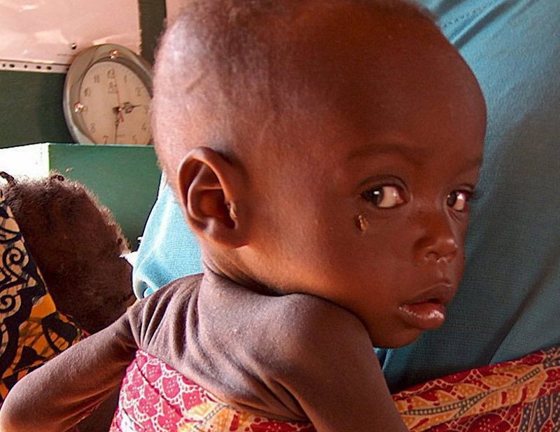 Save The Children: El Niño amenaza con llevar el hambre a ocho millones de niños de África